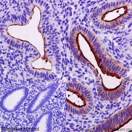 Immunohistochemistry (Formalin/PFA-fixed paraffin-embedded sections) - Anti-MUC1 antibody [EPR1023] - Low endotoxin, Azide free (AB194978), expandable thumbnail