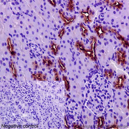 Immunohistochemistry (Formalin/PFA-fixed paraffin-embedded sections) - Anti-MUC1 antibody [EPR1023] - Low endotoxin, Azide free (AB194978), expandable thumbnail