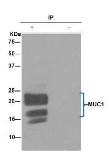 Immunoprecipitation - Anti-MUC1 antibody [EPR1023] - Low endotoxin, Azide free (AB194978), expandable thumbnail