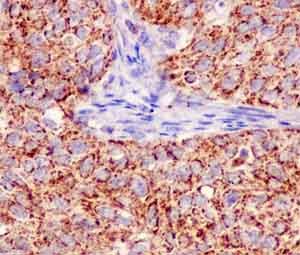 Immunohistochemistry (Formalin/PFA-fixed paraffin-embedded sections) - Anti-MUC1 antibody [EPR1025(2)] (AB181133), expandable thumbnail