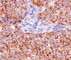 Immunohistochemistry (Formalin/PFA-fixed paraffin-embedded sections) - Anti-MUC1 antibody [EPR1025(2)] (AB181133)