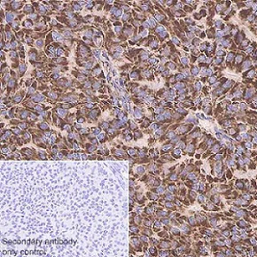 Immunohistochemistry (Formalin/PFA-fixed paraffin-embedded sections) - Anti-MUC1 antibody [EPR1025(2)] (AB181133)