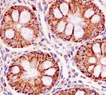 Immunohistochemistry (Formalin/PFA-fixed paraffin-embedded sections) - Anti-MUC1 antibody [EPR1025(2)] (AB181133), expandable thumbnail