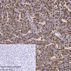 Immunohistochemistry (Formalin/PFA-fixed paraffin-embedded sections) - Anti-MUC1 antibody [EPR1025(2)] - BSA and Azide free (AB238994)
