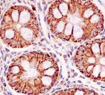 Immunohistochemistry (Formalin/PFA-fixed paraffin-embedded sections) - Anti-MUC1 antibody [EPR1025(2)] - BSA and Azide free (AB238994)