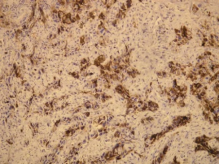 Immunohistochemistry (Formalin/PFA-fixed paraffin-embedded sections) - Anti-MUC1 antibody [G22-L] (AB136615)