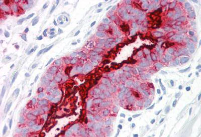 Immunohistochemistry (Formalin/PFA-fixed paraffin-embedded sections) - Anti-MUC1 antibody [GP1.4] (AB134282)