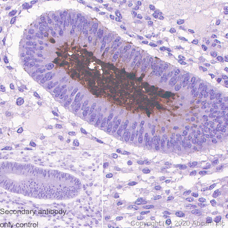Immunohistochemistry (Formalin/PFA-fixed paraffin-embedded sections) - Anti-MUC1 antibody [HMFG1 (aka 1.10.F3)] (AB70475)