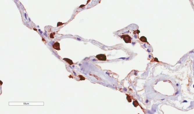 Immunohistochemistry (Formalin/PFA-fixed paraffin-embedded sections) - Anti-MUC1 antibody [HMFG2] (AB245693)