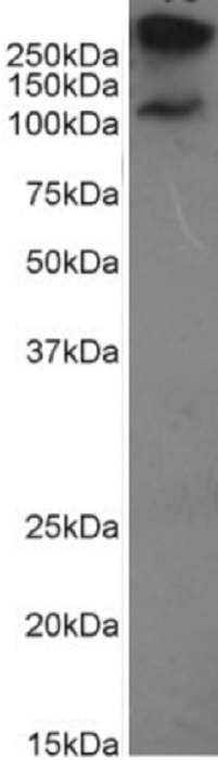 Western blot - Anti-MUC1 antibody [HMFG2] (AB245693), expandable thumbnail