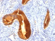 Immunohistochemistry (Formalin/PFA-fixed paraffin-embedded sections) - Anti-MUC1 antibody [MUC1/955] - BSA and Azide free (AB212621)