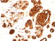 Immunohistochemistry (Formalin/PFA-fixed paraffin-embedded sections) - Anti-MUC1 antibody [rMUC1/960] (AB218464)
