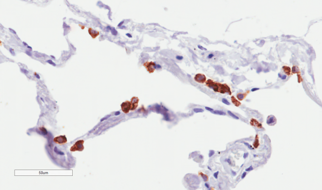 Immunohistochemistry (Formalin/PFA-fixed paraffin-embedded sections) - Anti-MUC1 antibody [SM3] (AB245695)