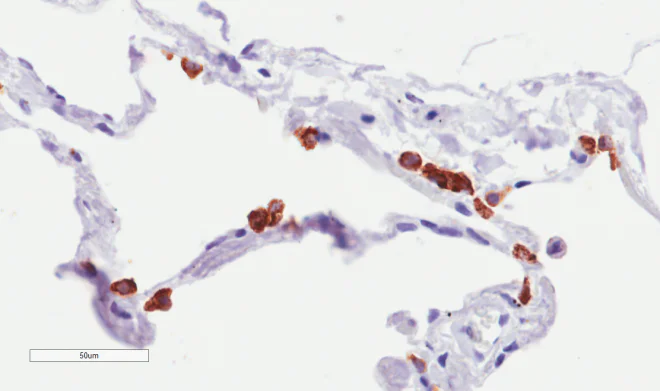 Immunohistochemistry (Formalin/PFA-fixed paraffin-embedded sections) - Anti-MUC1 antibody [SM3] (AB245695)