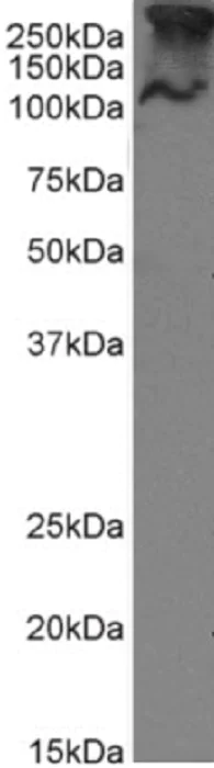 Western blot - Anti-MUC1 antibody [SM3] (AB245695)
