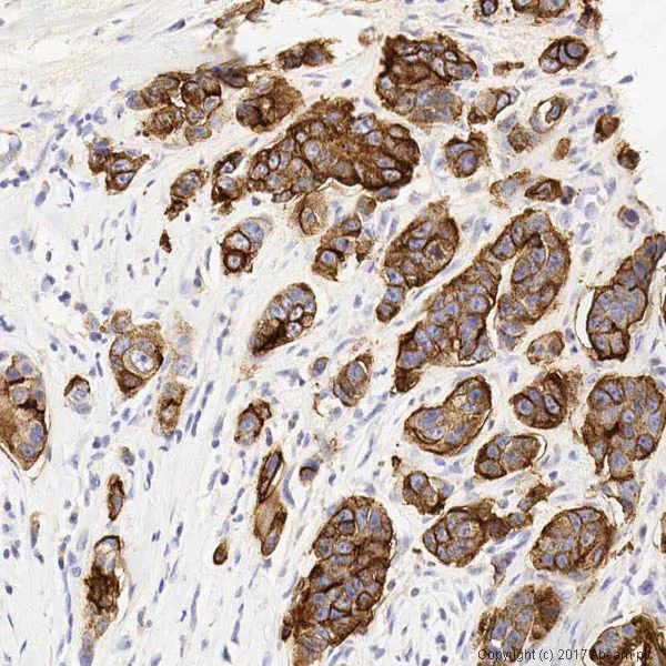 Immunohistochemistry (Formalin/PFA-fixed paraffin-embedded sections) - Anti-MUC1 antibody [SM3] - BSA and Azide free (AB230294)