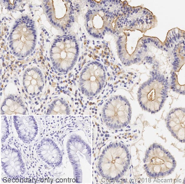 Immunohistochemistry (Formalin/PFA-fixed paraffin-embedded sections) - Anti-MUC13 antibody [C18] - BSA and Azide free (AB269565)