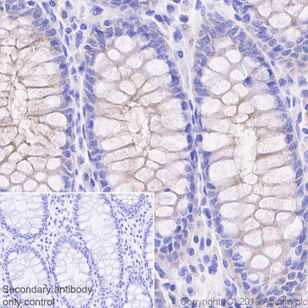 Immunohistochemistry (Formalin/PFA-fixed paraffin-embedded sections) - Anti-MUC13 antibody [EPR21901] - BSA and Azide free (AB237590), expandable thumbnail