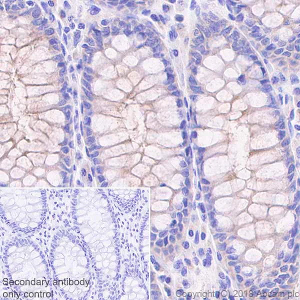 Immunohistochemistry (Formalin/PFA-fixed paraffin-embedded sections) - Anti-MUC13 antibody [EPR21901] - BSA and Azide free (AB237590)