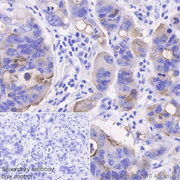 Immunohistochemistry (Formalin/PFA-fixed paraffin-embedded sections) - Anti-MUC13 antibody [EPR21901] - BSA and Azide free (AB237590), expandable thumbnail