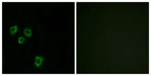 Immunocytochemistry/ Immunofluorescence - Anti-MUC16 antibody (AB133419)