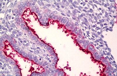 Immunohistochemistry (Formalin/PFA-fixed paraffin-embedded sections) - Anti-MUC16 antibody (AB133419), expandable thumbnail