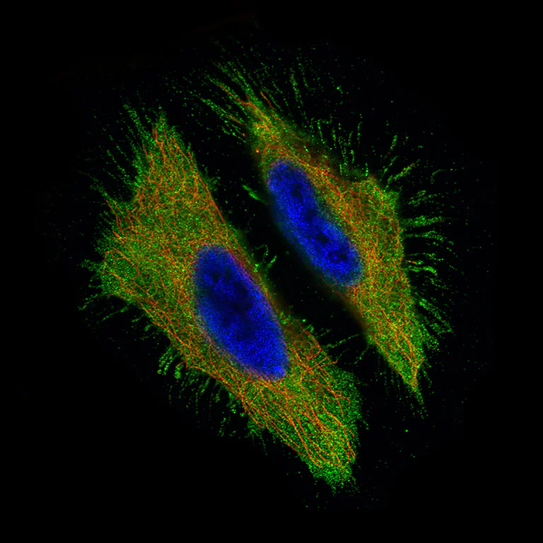 Immunocytochemistry/ Immunofluorescence - Anti-MUC16 antibody [CL2782] (AB272333)