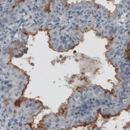 Immunohistochemistry (Formalin/PFA-fixed paraffin-embedded sections) - Anti-MUC16 antibody [CL2782] (AB272333)