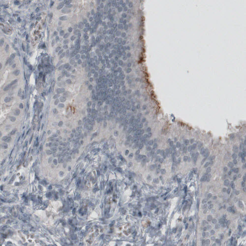 Immunohistochemistry (Formalin/PFA-fixed paraffin-embedded sections) - Anti-MUC16 antibody [CL2782] (AB272333)