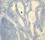 Immunohistochemistry (Formalin/PFA-fixed paraffin-embedded sections) - Anti-MUC16 antibody [EPR1020(2)] (AB110640)