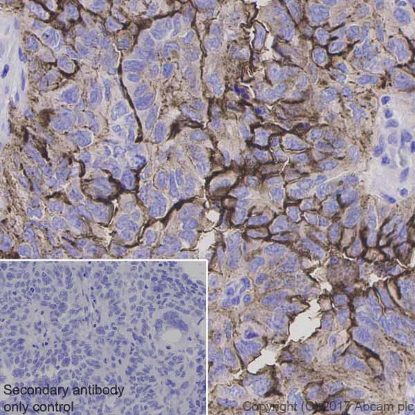 Immunohistochemistry (Formalin/PFA-fixed paraffin-embedded sections) - Anti-MUC16 antibody [EPR1020(2)] (AB110640)