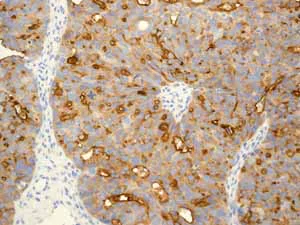 Immunohistochemistry (Formalin/PFA-fixed paraffin-embedded sections) - Anti-MUC16 antibody [EPR1020(2)] - BSA and Azide free (AB230497)