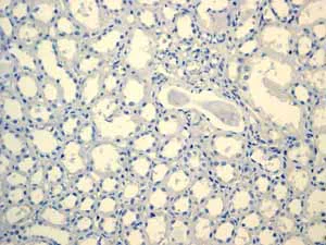Immunohistochemistry (Formalin/PFA-fixed paraffin-embedded sections) - Anti-MUC16 antibody [EPR1020(2)] - BSA and Azide free (AB230497)