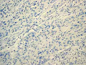 Immunohistochemistry (Formalin/PFA-fixed paraffin-embedded sections) - Anti-MUC16 antibody [EPR1020(2)] - BSA and Azide free (AB230497)