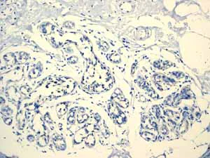Immunohistochemistry (Formalin/PFA-fixed paraffin-embedded sections) - Anti-MUC16 antibody [EPR1020(2)] - BSA and Azide free (AB230497)