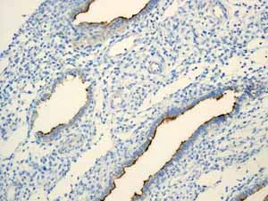 Immunohistochemistry (Formalin/PFA-fixed paraffin-embedded sections) - Anti-MUC16 antibody [EPR1020(2)] - BSA and Azide free (AB230497)