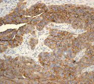 Immunohistochemistry (Formalin/PFA-fixed paraffin-embedded sections) - Anti-MUC16 antibody [EPR1020(2)] - BSA and Azide free (AB230497)