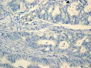 Immunohistochemistry (Formalin/PFA-fixed paraffin-embedded sections) - Anti-MUC16 antibody [EPR1020(2)] - BSA and Azide free (AB230497)