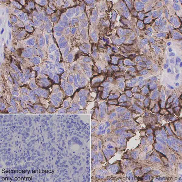 Immunohistochemistry (Formalin/PFA-fixed paraffin-embedded sections) - Anti-MUC16 antibody [EPR1020(2)] - BSA and Azide free (AB230497)