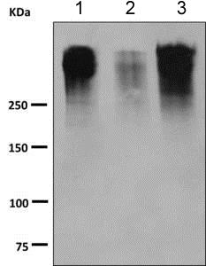 Western blot - Anti-MUC16 antibody [EPSISR23-96] (AB168360)