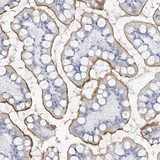 Immunohistochemistry (Formalin/PFA-fixed paraffin-embedded sections) - Anti-MUC17 antibody (AB122184)