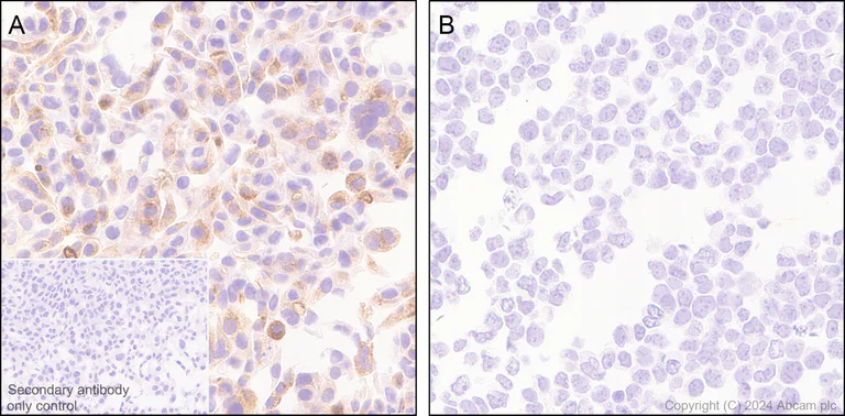 Immunohistochemistry (Formalin/PFA-fixed paraffin-embedded sections) - Anti-MUC17 antibody [EPR28482-85] (AB316971)