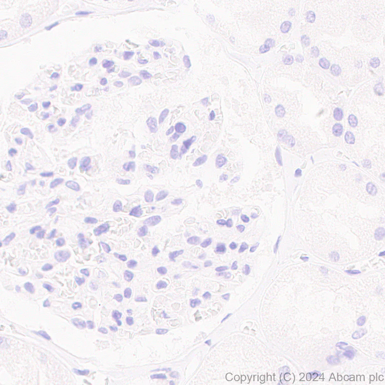 Immunohistochemistry (Formalin/PFA-fixed paraffin-embedded sections) - Anti-MUC17 antibody [EPR28482-85] (AB316971)