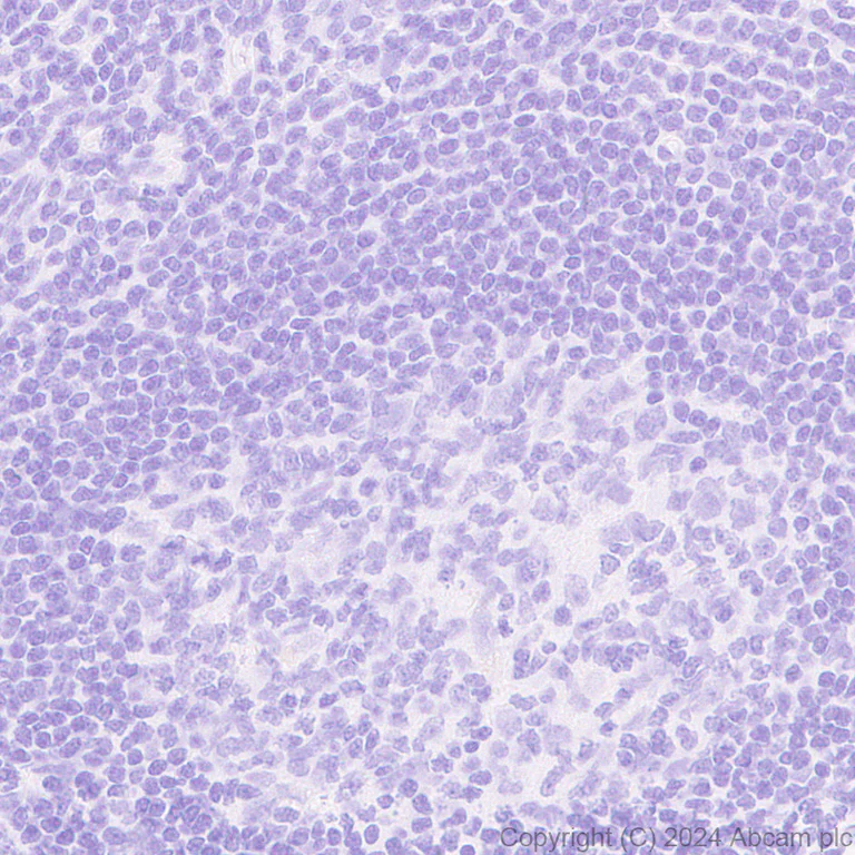 Immunohistochemistry (Formalin/PFA-fixed paraffin-embedded sections) - Anti-MUC17 antibody [EPR28482-85] (AB316971)