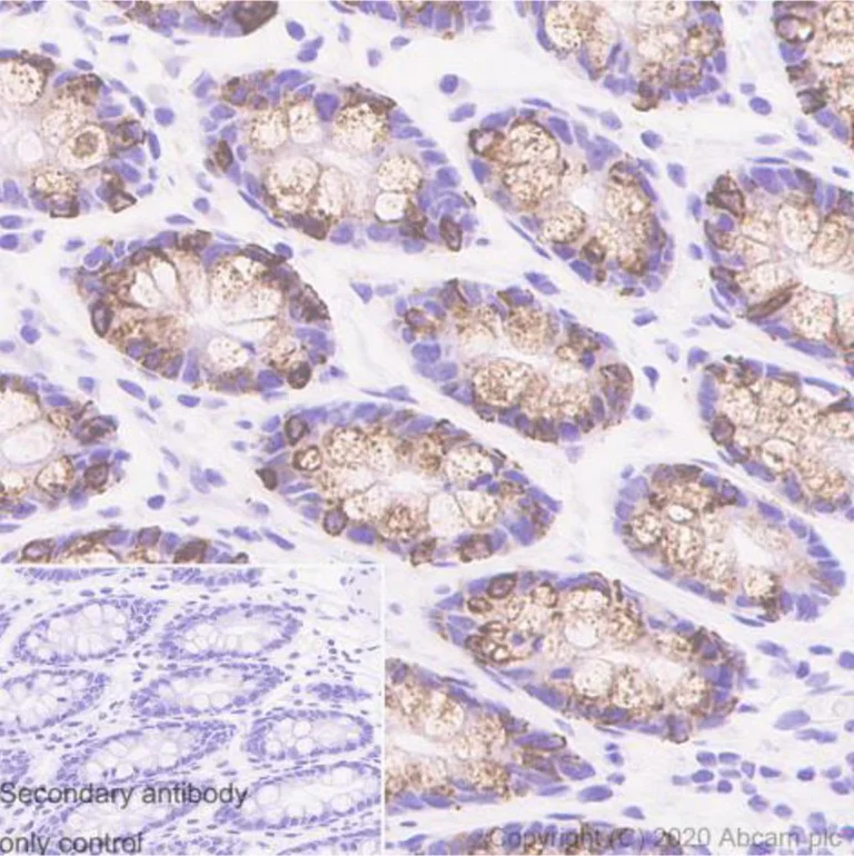 Immunohistochemistry (Formalin/PFA-fixed paraffin-embedded sections) - Anti-MUC2 antibody [996/1] (AB11197)