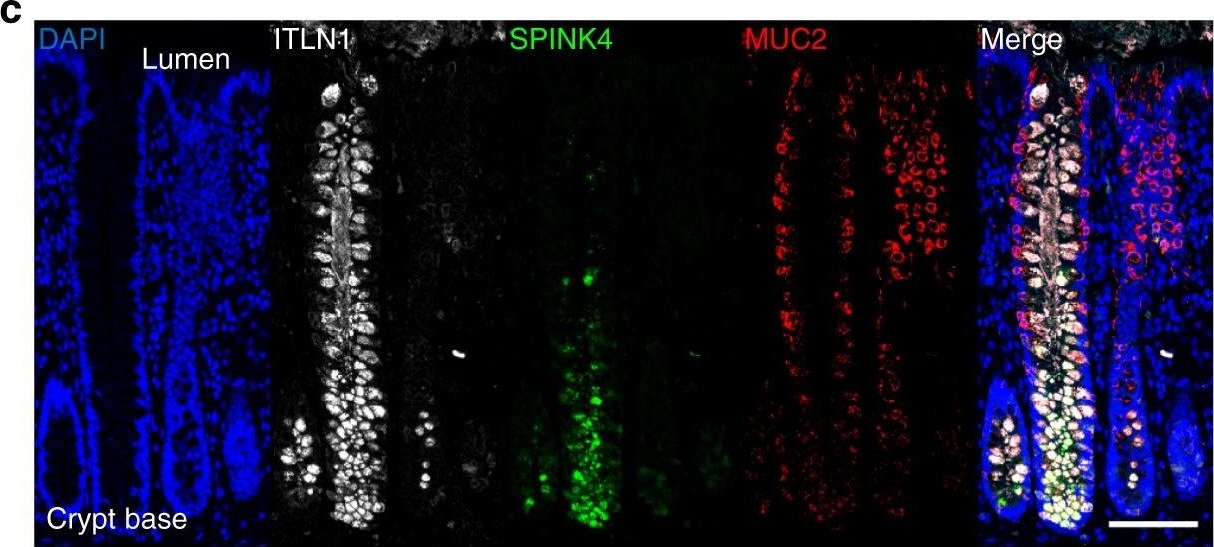 Immunohistochemistry - Anti-MUC2 antibody [996/1] (AB11197)