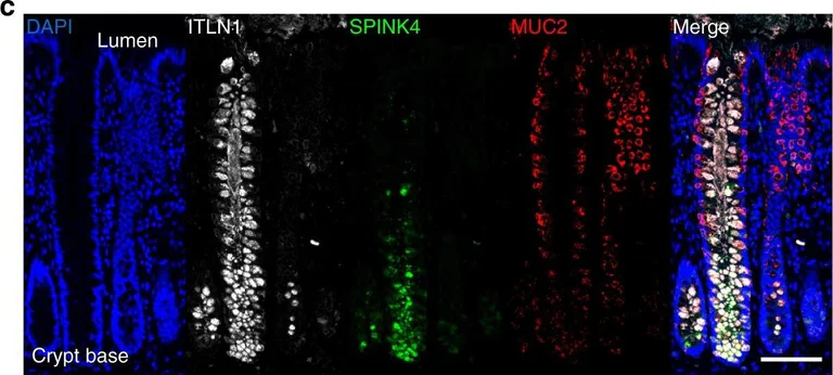 Immunohistochemistry - Anti-MUC2 antibody [996/1] (AB11197)