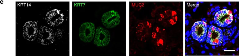 Immunohistochemistry - Anti-MUC2 antibody [996/1] (AB11197)