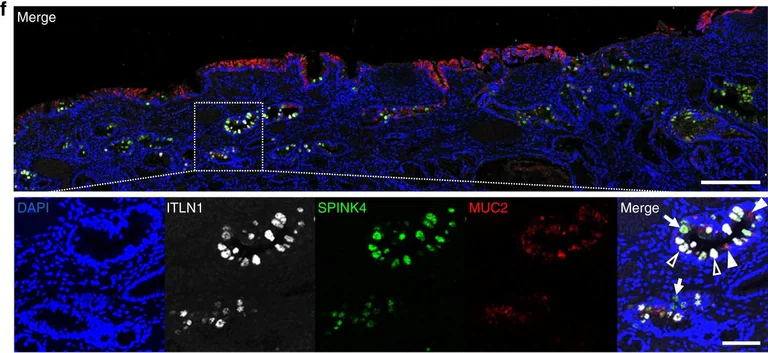 Immunohistochemistry - Anti-MUC2 antibody [996/1] (AB11197)