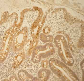 Immunohistochemistry (Formalin/PFA-fixed paraffin-embedded sections) - Anti-MUC2 antibody (AB76774)